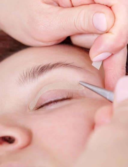 http://www.phoenixcosmeticcentre.com/blephroplasty